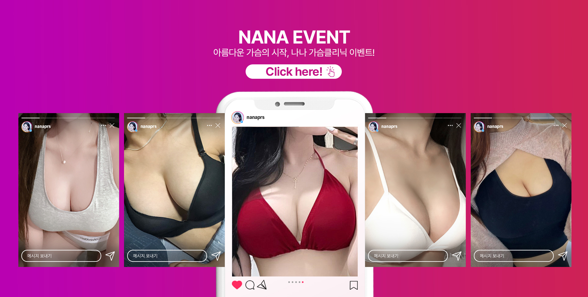 NANA EVENT 아름다운 가슴의 시작, 나나 가슴클리닉 이벤트! Click here