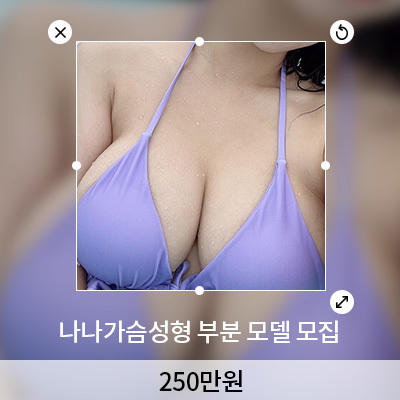 나나 가슴성형 부분모델모집 이미지