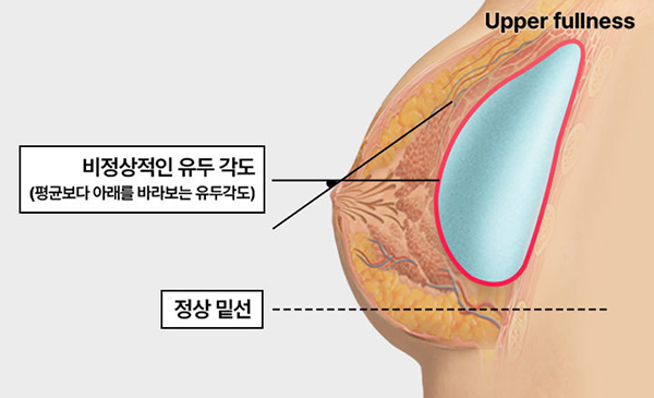 콘텐츠이미지