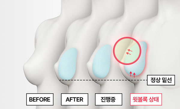 콘텐츠이미지