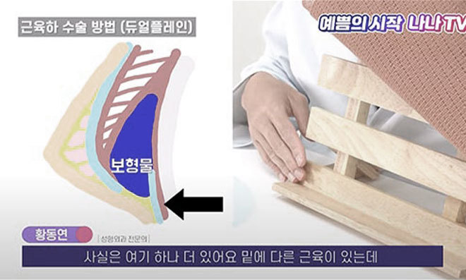 듀얼플레인+