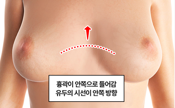 recommend이미지