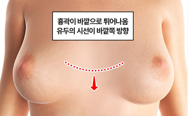 recommend이미지